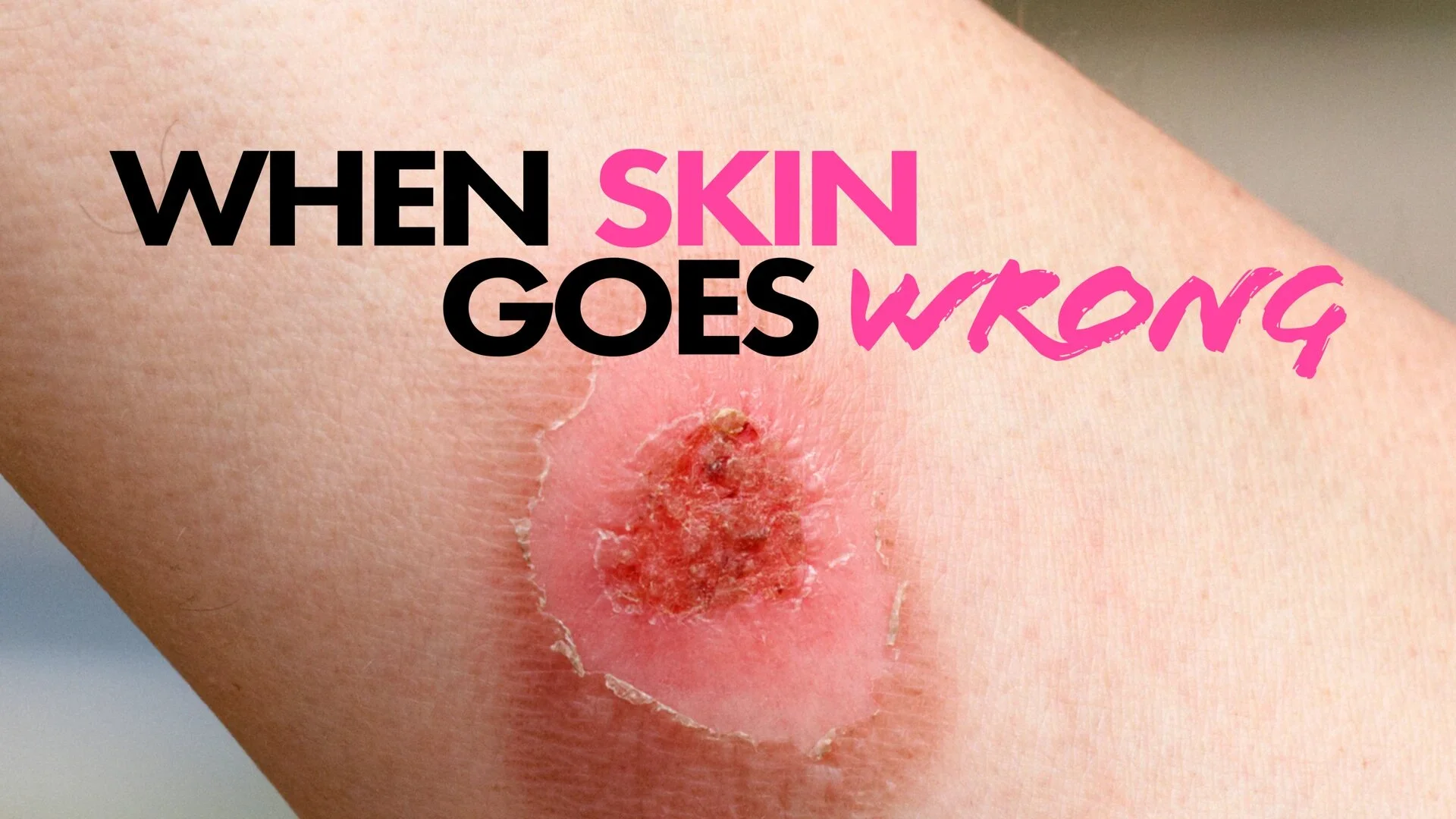 When Skin Goes Wrong