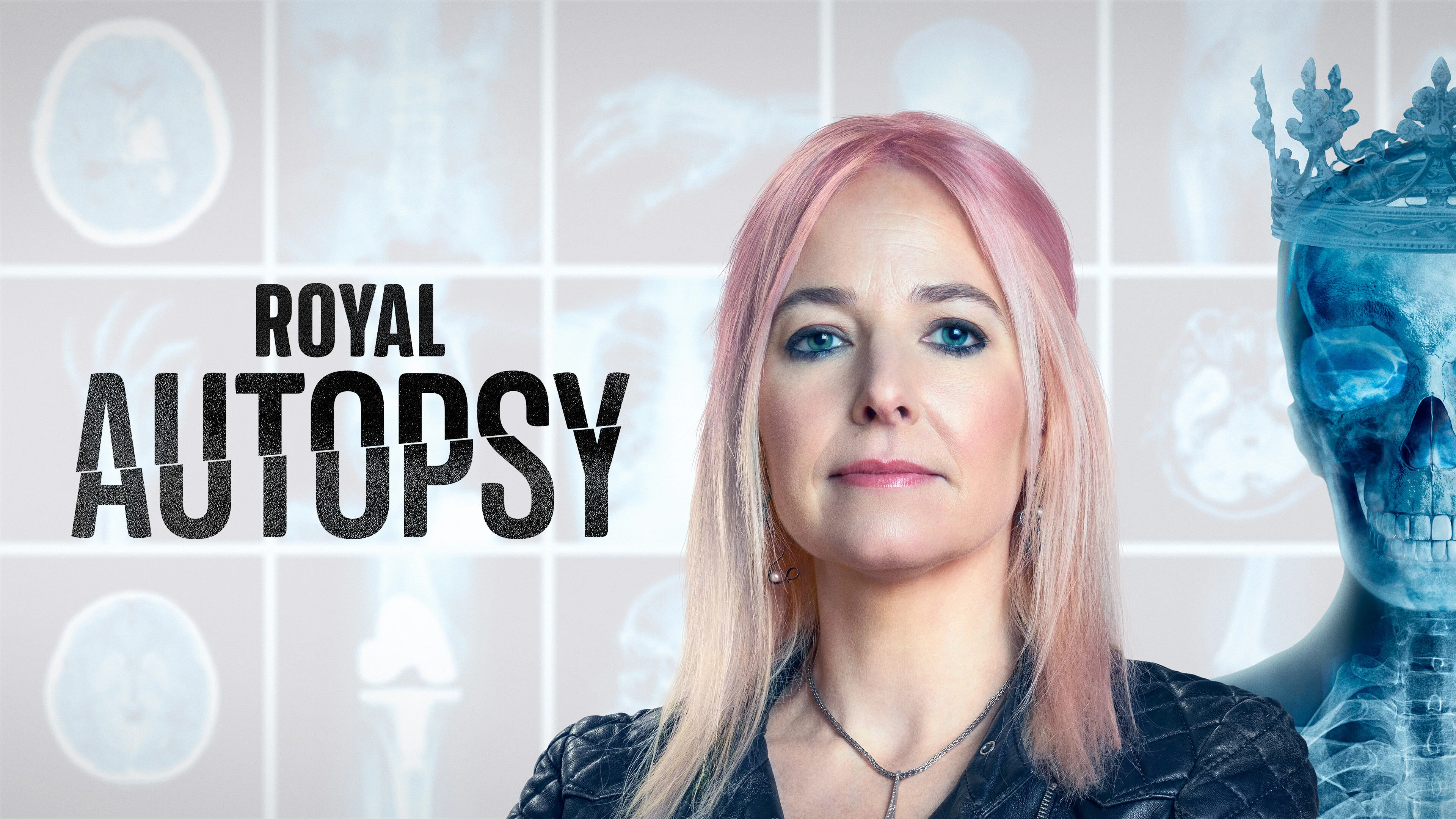 Royal Autopsy